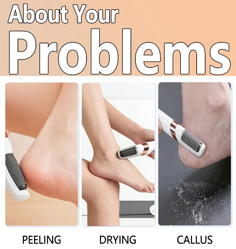Foot Scrubber Grinder Exfoliator Skin Callus Remover
